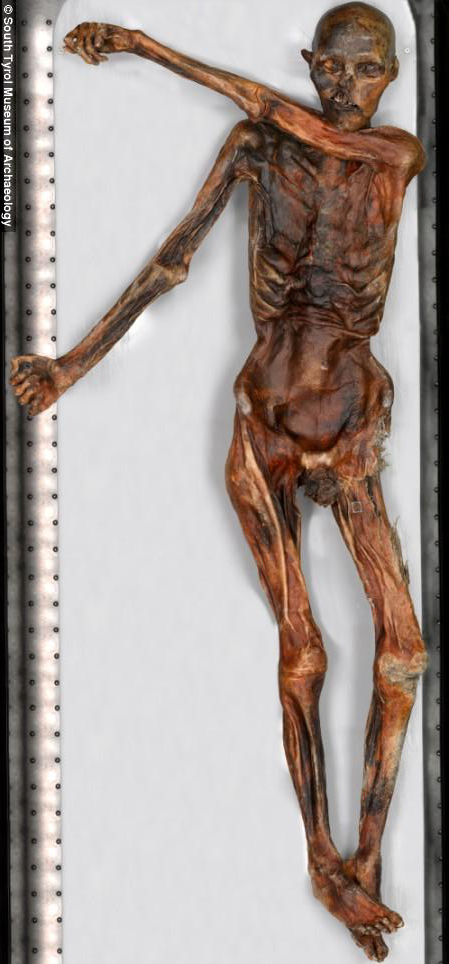 ozti the iceman